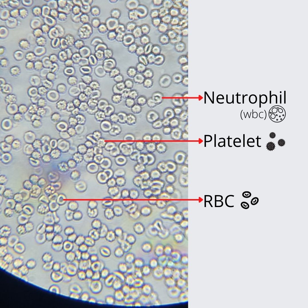 রক্ত কণিকা সমূহ কি কি, উৎপত্তি ও কাজ – ভিডিও সহ